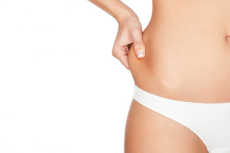 intervenţia de lipoaspiraţie, liposuctie